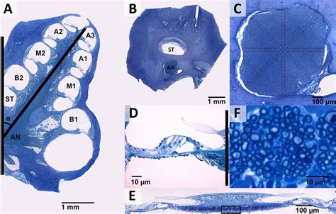 Histological Processing Of The Cochlea A Mid Modiolar Section Of The