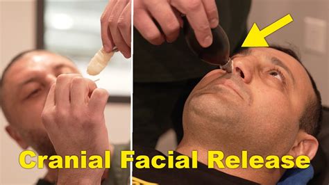 How To Perform Cranial Facial Release Technique On A Patient Youtube