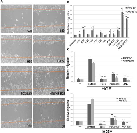 Figure 1 From Enhanced Pkcδ And Erk Signaling Mediate Cell Migration Of