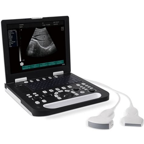 China Handheld Ultrasound Machines Manufacturer And Supplier Factory
