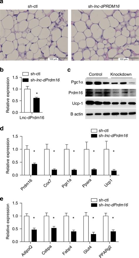 De Novo Reconstruction Of Human Adipose Transcriptome Reveals Conserved