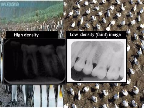 Artifact And Errors In Intraoral Periapical Radiograph Ppt