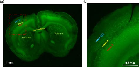 (a) Expression of channelrhodopsin-2 (ChR2) in Thy1-ChR2 mice. (b)... | Download Scientific Diagram