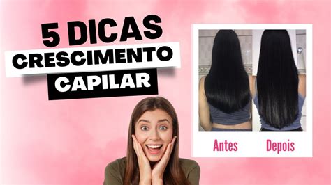 O QUE EU FIZ PARA O MEU CABELO CRESCER MUITO 5 DICAS Infalíveis para