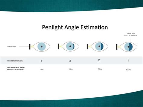 Narrow angles talk | PPT