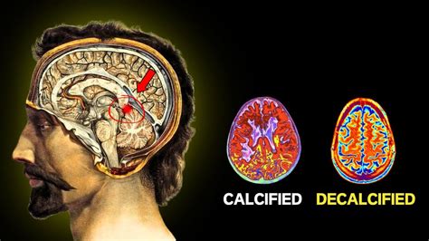 The Pineal Power Ways To Decalcified Your Pineal Gland Awakening