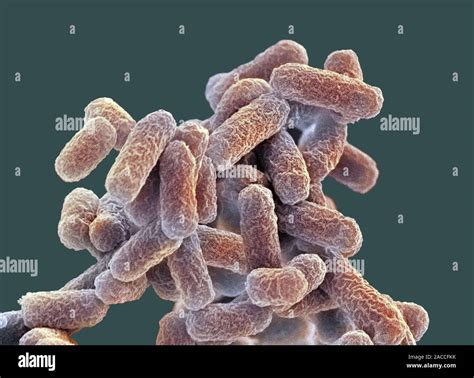 E Coli Bakterien Farbige Scanning Electron Micrograph Sem Von