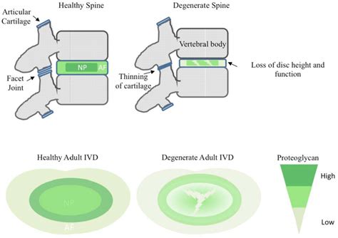 Schematic Representation Of A Human Adult Spine Motion Segment Healthy