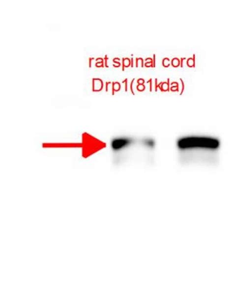 DRP1 Antibody BSA Free Novus Biologicals 0 1mL Unlabeled Fisher