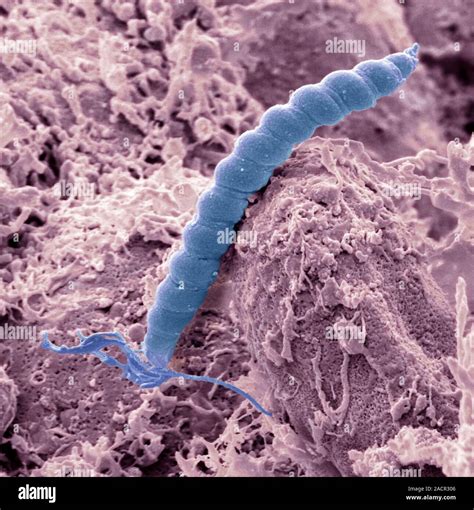 Helicobacter Pylori Bacteria Coloured Scanning Electron Micrograph