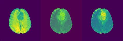 GitHub - ambideXtrous9/UNet-on-Brain-MRI-Images: Re-Generate Brain MRI ...