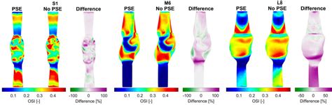 Frontiers Corrigendum Ultrasound Based Fluid Structure Interaction