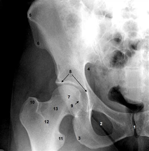 HSC 475 Exam 3 Radiology Flashcards Quizlet