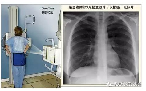 肺癌患者应该了解的诊断和检查大全 知乎