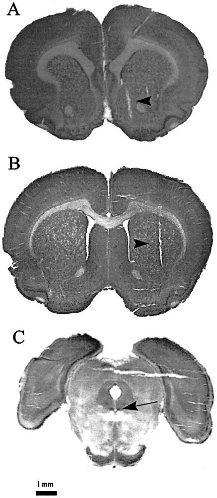 Photomicrographs From Cresyl Violet Stained Coronal Brain Sections