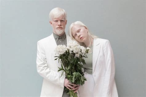 Albinos Causas Del Albinismo Problemas De Salud Y Sociales