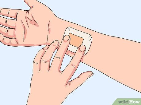 Ways To Heal An Infected Cut Wikihow