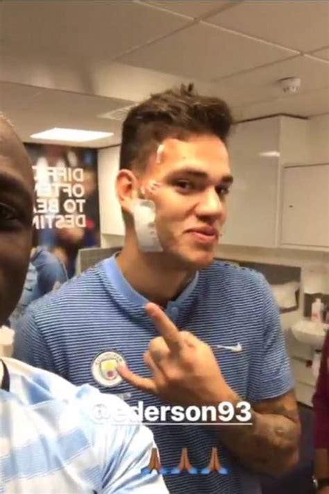 Ederson Suffers No Broken Bones In Sadio Mane Clash Daily Mail Online