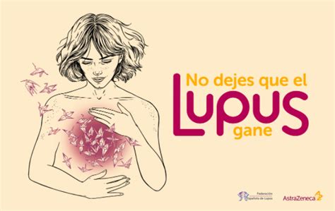 Campa A No Dejes Que El Lupus Gane Lupus Malaga Y Autoinmunes