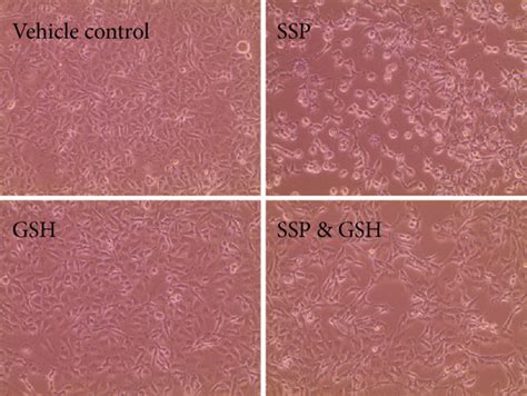 Gsh Blocked Ssp Induced Pyroptotic Signaling Pathways In Tnbc Cells Download Scientific