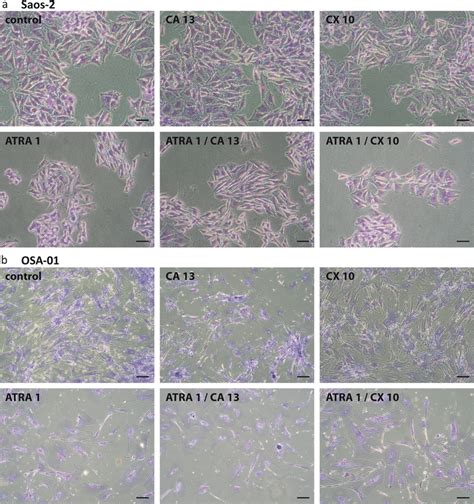 Morphology Of Saos 2 A And OSA 01 B Cells Control Or Treated With