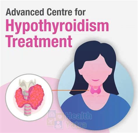 Hypothyroidism Symptoms Causes Treatment And Medication In India