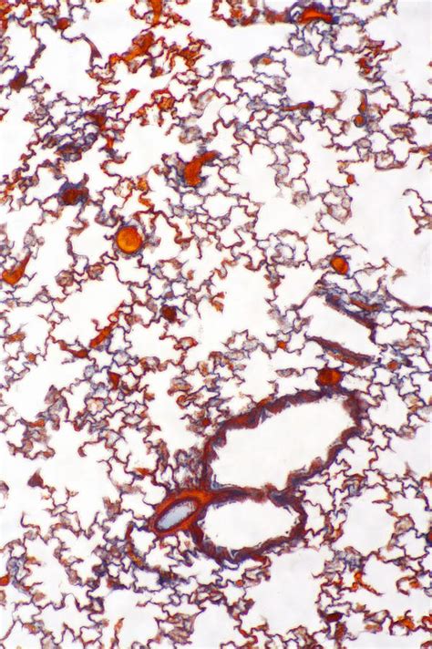 Alveoli, Capillaries & Bronchioles, Lm Photograph by Science Stock ...