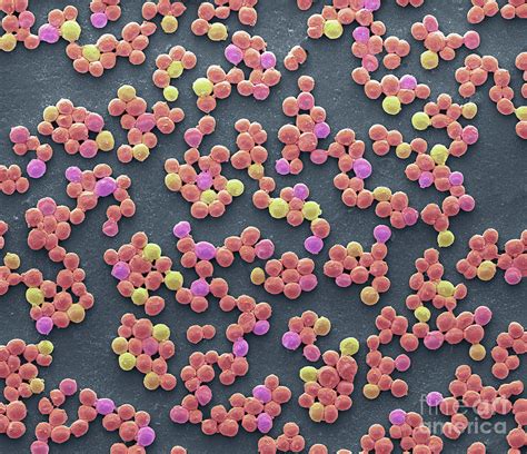 Group A Streptococcus Bacteria 1 By Steve Gschmeissnerscience Photo