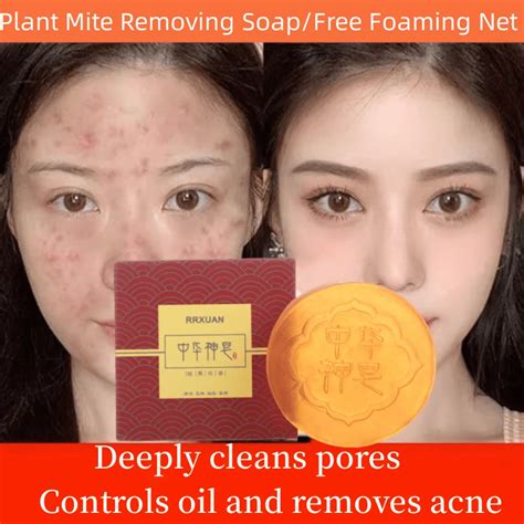 New Herbal Mite Soap Face Back Acne Removal Oil Control Keratosis