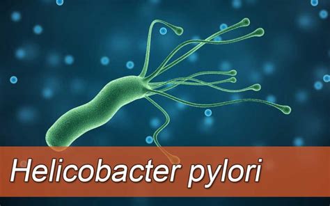 Helicobacter Pylori H Pylori Koji Su Simptomi Infekcije I Kad I Hot