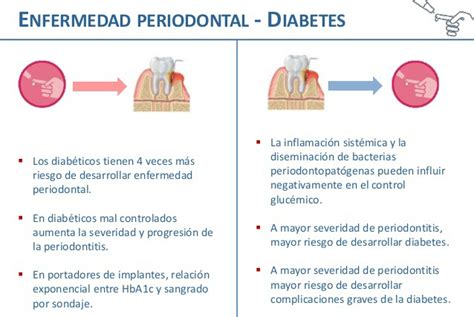 Mapa Conceptual Relaci N Diabetes Y Enfermedad Periodontal