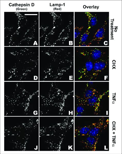 Cathepsin D And Lamp 1 Staining And Co Localization In Tao Cultures