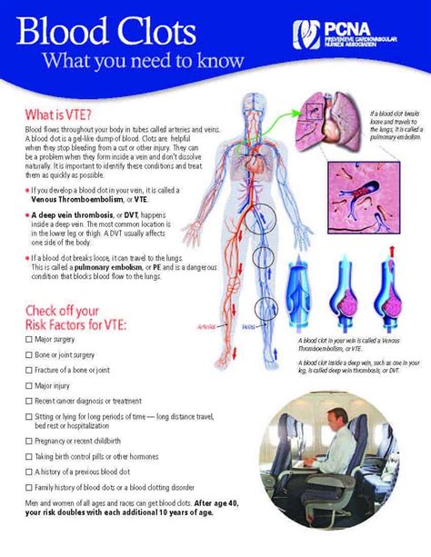 Cardiac Patient Education Tools And Handouts Pcna