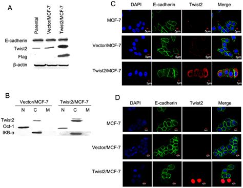 The Regulation Of E Cadherin Expression By Twist In Breast Cancer