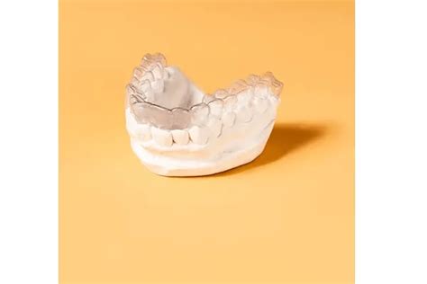 Qué es la dentadura postiza fija sin implantes - P&P Clinic