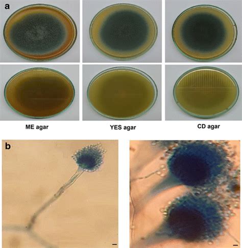 Macroscopic And Microscopic Characteristics Of A Fumigatus Txd A