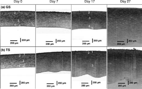 Representative Cross Sectional OCT Images Of Corneas In Preservation