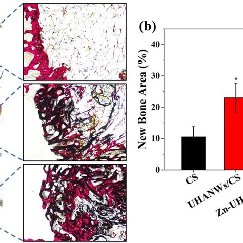 Histological Analysis For The Bone Regeneration In The Critical Sized Rat Download Scientific