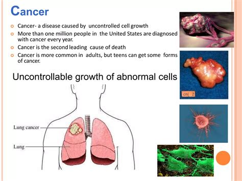 Causes and Effects of Lifestyle diseases | PPT