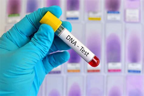 Dna Testing Market Size, Share, Growth | Forecast to 2027