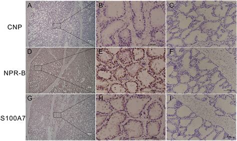 Frontiers C Type Natriuretic Peptide Regulates The Expression And