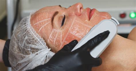 **Hifu Mage: The Revolutionary Skin Tightening Treatment That Will Transform Your Appearance**