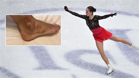 **Unveiling the Secrets of Ice Skating Blisters: A Comprehensive Guide**