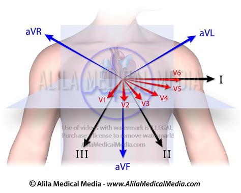 12 lead diagram anatomy 