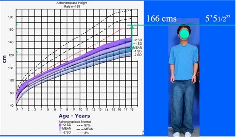Achondroplasia Height Chart