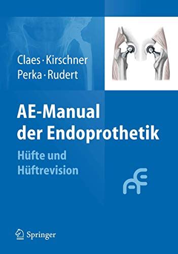 Ae Manual Der Endoprothetik Hufte Und Huftrevision