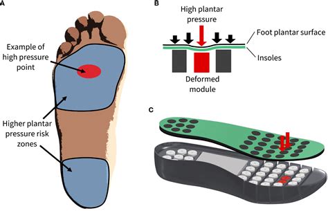 Assessment of the Impact of Loading Pressure on Endothelial Function in Diabetic Foot book cover