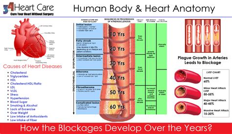 Average Artery Blockage By Age Chart