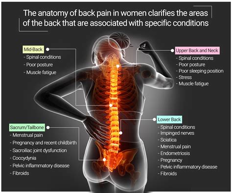 Back Pain Chart Woman