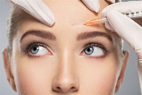 Botox Nasolabialveck: En revolutionerande behandling för ett yngre utseende